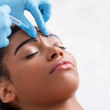How To Best Recover From Your Botox Treatment